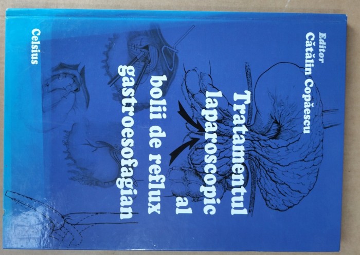 TRATAMENTUL LAPAROSCOPIC AL BOLII DE REFLUX GASTROESOFAGIAN( CONTINE CD)- CATALIN COPAESCI-X4.