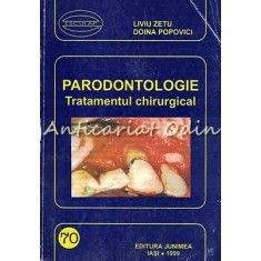 Parodontologie. Tratamentul Chirurgical - Liviu Zetu, Doina Popovici
