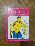 Acupunctura in Medicina Generala - Dr. Adrian P. Adam, 1995 / R3F