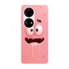 Husa compatibila cu Huawei Nova 8i model Patrick Drooling SpongeBob, Silicon, TPU, Viceversa, Transparent, Carcasa