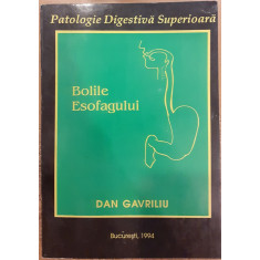 Patologie digestiva superioara. Bolile esofagului