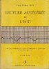 Lecture Acceleree de L ECG