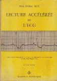 Lecture Acceleree de L ECG