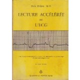Lecture Acceleree de L ECG