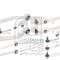 FEBI BILSTEIN 39404 Set, suspensie roata