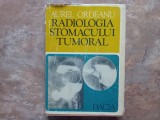 Aurel Ordeanu - Radiologia stomacului tumoral, 1977