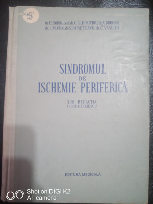 Sindromul de ischemie periferica-Prof.Dr.C.C.Iliescu foto