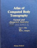 Cumpara ieftin Atlas of Computed Body Tomography. Normal and Abnormal Anatomy - 1980 - Rolf L. Schapiro (#C24)