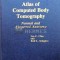 Atlas of Computed Body Tomography. Normal and Abnormal Anatomy - 1980 - Rolf L. Schapiro (#C24)