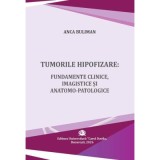 Tumorile hipofizare. Fundamente clinice, imagistice si anatomo-patologice - Anca Buliman