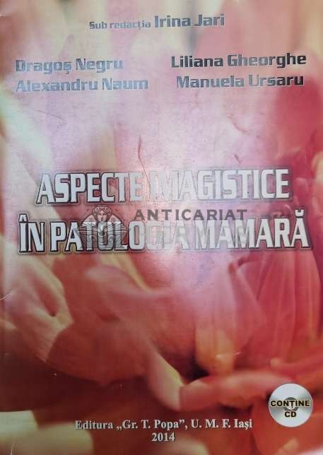 Aspecte imagistice &icirc;n patologia mamara - 2017 - Irina Jari (X2)