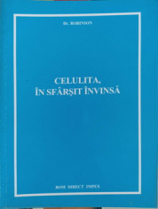 CELULITA, IN SFARSIT INVINSA-DR. ROBINSON foto