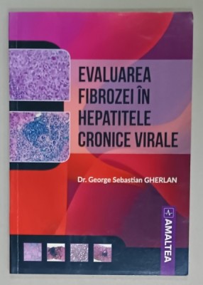 EVALUAREA FIBROZEI IN HEPATITELE CRONICE VIRALE de Dr. GEORGE SEBASTIAN GHERLAN , 2018 foto