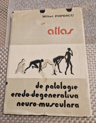 Atlas de patologie eredo- degenerativa neuro - musculara Mihai Popescu foto