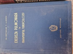 Exereza pulmonară in tratamentul tuberculozei vintage