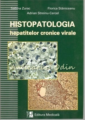 Histopatologia Hepatitelor Cronice Virale - Sabina Zurac, Florica Staniceanu foto