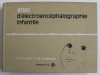 ATLAS D &#039; ELECTROENCEPHALOGRAPHIE INFANTILE par P. LAGET et R. SALBREUX , 1967
