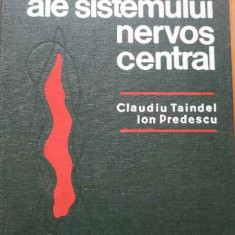 Infectii Acute Ale Sistemului Nervos Central - Claudiu Taindel Ion Predescu ,292213