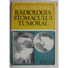 Radiologia stomacului tumoral &ndash; Aurel Ordeanu
