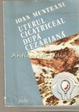 Cumpara ieftin Uterul Cicatriceal Dupa Cezariana, Ioan Munteanu, 1985, Facla, Medicina, Ginecologie, Carte, Romana