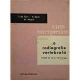 S. de Seze - Cum interpretam o radiografie vertebrala (Editia: 1965)