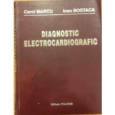 Diagnostic electrocardiografic