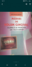 Mariri de volum gingival-Clinica si principii de tratament foto
