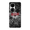Husa compatibila cu Huawei Nova Y70 model Dope Mickey Mouse, Silicon, TPU, Viceversa, Transparent, Carcasa
