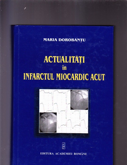 ACTUALITATI IN INFARCTUL MIOCARDIC ACUT