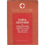 Caria dentara si prevenirea infectiilor de focar dentare - Traian Petrescu