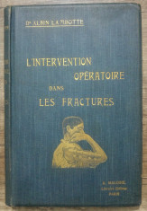 L&amp;#039;intervention operatoire dans les fractures - Albin Lambotte/ 1907 foto