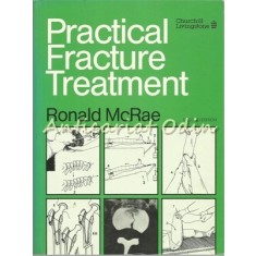 Practical Fracture Treatment - Ronald Rose