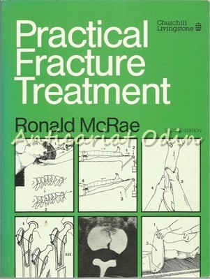 Practical Fracture Treatment - Ronald Rose