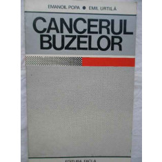 Cancerul Buzelor - Emanoil Popa Emil Urtila ,270670