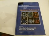 Multiple sclerosis