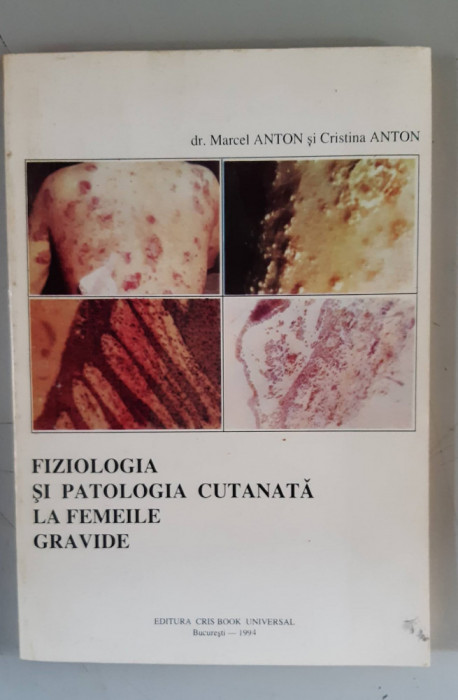 Fiziologia si patologia cutanata la femeile gravide - M.Anton , C.Anton
