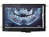 Afisaj TFT, grafic, matrice IPS, rezolutie 800x480, 7", 3,3V DC, NEWHAVEN DISPLAY INTERNATIONAL - NHD-7.0-800480FT-CSXP-CTP