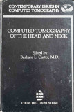 COMPUTED TOMOGRAPHY OF THE HEAD AND NECK-EDITED BY BARBARA L. CARTER, M.D.