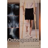 Emil Radulescu - Osteoporoza - cauze si prevenire (Editia: 2004)