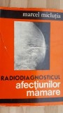 Radiodiagnosticul afectiunilor mamare- Marcel Miclutia