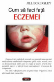 Cum să faci faţă eczemei - Paperback brosat - Jill Eckersley - Antet Revolution