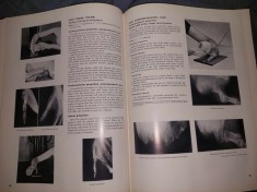 Carte veche Medicina 1967,ATLAS DE POZITII RADIOGENOGRAFICE,Vinita Merill,Anatomie generala si termeni anatomici,Etape preliminare in roentgenografie