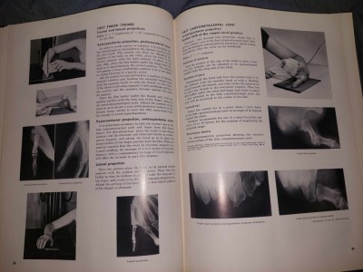 Carte veche Medicina 1967,ATLAS DE POZITII RADIOGENOGRAFICE,Vinita Merill,Anatomie generala si termeni anatomici,Etape preliminare in roentgenografie foto