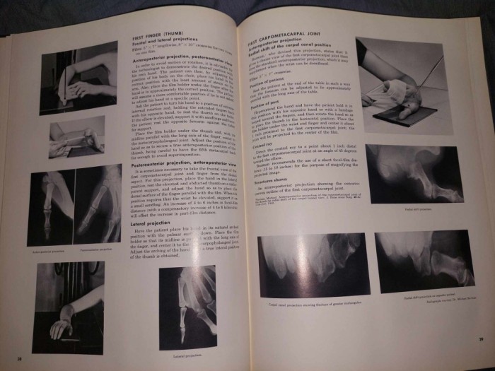 Carte veche Medicina 1967,ATLAS DE POZITII RADIOGENOGRAFICE,Vinita Merill,Anatomie generala si termeni anatomici,Etape preliminare in roentgenografie