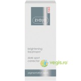 Ziaja Med - Corector pentru Albirea Petelor Pigmentare 30ml