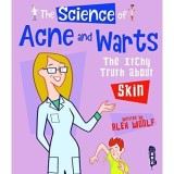 The Science of Acne &amp; Warts: The Itchy Truth About Skin