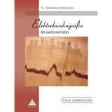 Elektrokardiogr&aacute;fia - 60 esetismertet&eacute;s - Dr. Debabrata Mukherjee