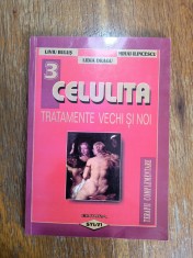 Celulita, tratamente vechi si noi - Liviu Bulus / R4P1S
