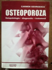 Osteoporoza-fiziopatologie,diagnostic,tratament-Carmen Georgescu foto