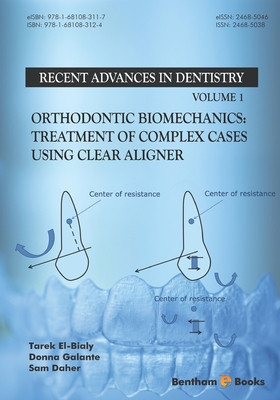 Orthodontic Biomechanics: Treatment Of Complex Cases Using Clear Aligner foto
